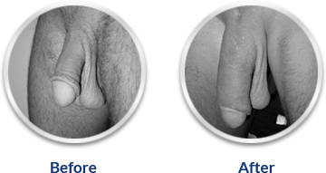 Ultra Power Capsule!